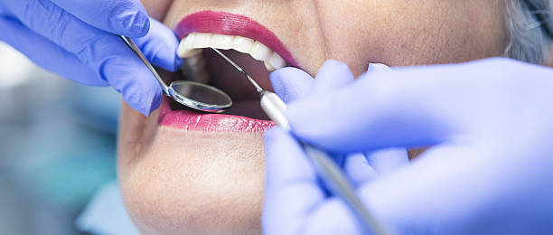 Best Emergency Cosmetic Dentistry (e.g., broken veneers) in Rosedale, MS